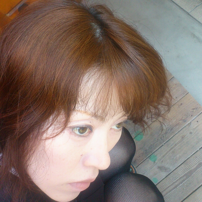 剥離骨折っぽい。