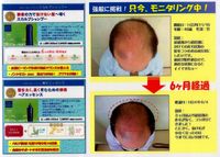 毛、生えてますね～。